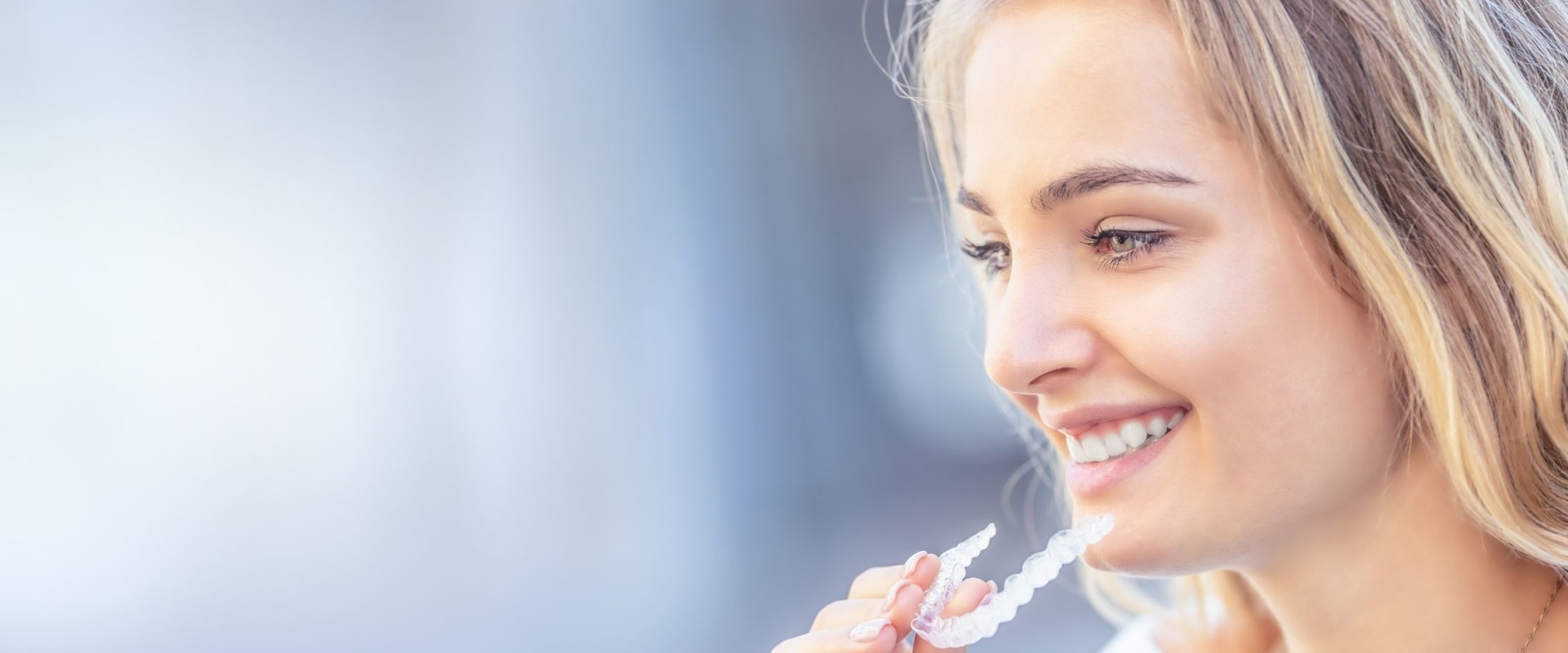 Are Spark Aligners Faster Than Braces or Other Clear Aligners?