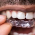 Are Clear Aligners the Best Option for Your Teeth?