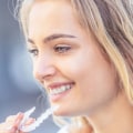 Are Spark Aligners Faster Than Braces or Other Clear Aligners?