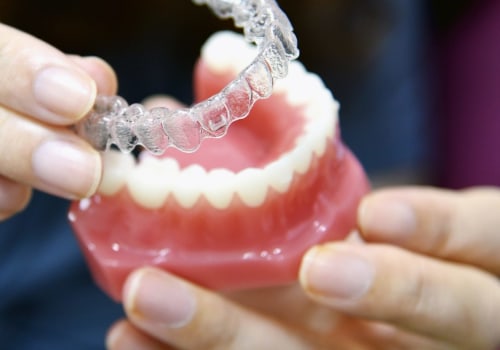 Which Clear Aligners are the Best in the UK?