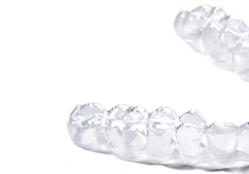 The Difference Between Clear Aligners and Retainers Explained