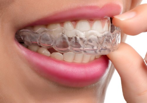 Can Clear Aligners Straighten Teeth?